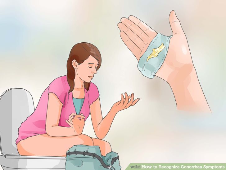 Obat Kencing Nanah Yang Terbukti Aman Dan Ampuh