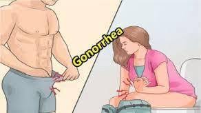 Cara Mengobati Kontol BAK Sakit Dan Cairan Putih Seperti Susu