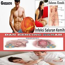 Nama Obat Kemaluan Nyeri Pada Saat Kencing Dan Keluar Seperti Nanah Di Apotik SBY