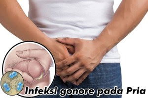 Nama Obat Vagina Saat Kencing Dan Keluar Nanah di Apotik SBY