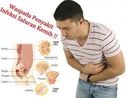 Obat Yang Tepat Untuk ISk (Infeksi Saluran Kemih) Di Apotik