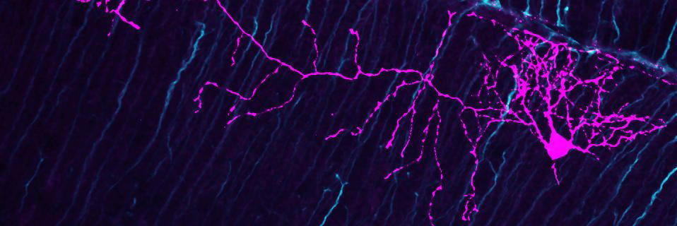 L'OPTOGÉNÉTIQUE : CONTRÔLER LE CERVEAU AVEC DE LA LUMIÈRE