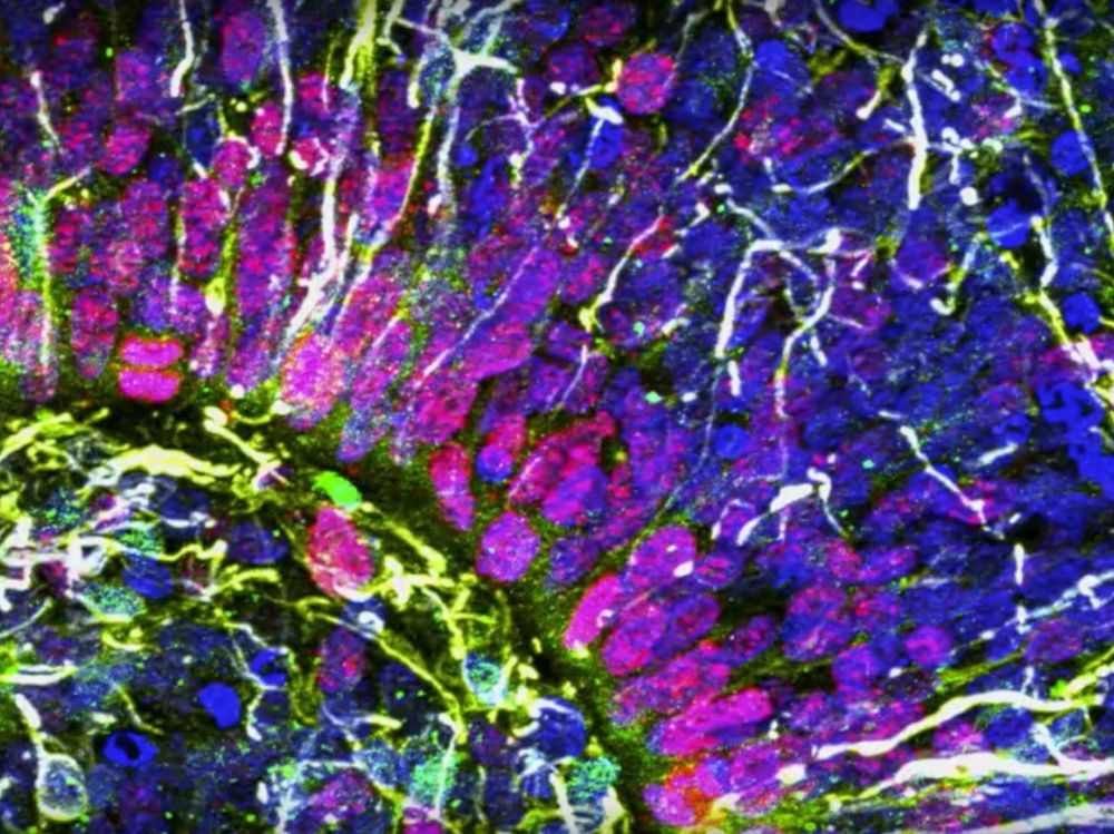 Un "mini-cerveau" humain créé en laboratoire s'active comme un cerveau de nouveaux-nés prématurés