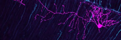 L'OPTOGÉNÉTIQUE : CONTRÔLER LE CERVEAU AVEC DE LA LUMIÈRE