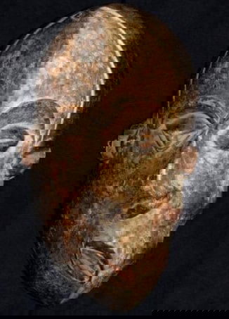 La difformité faciale dans l'art Africain traditionnel.