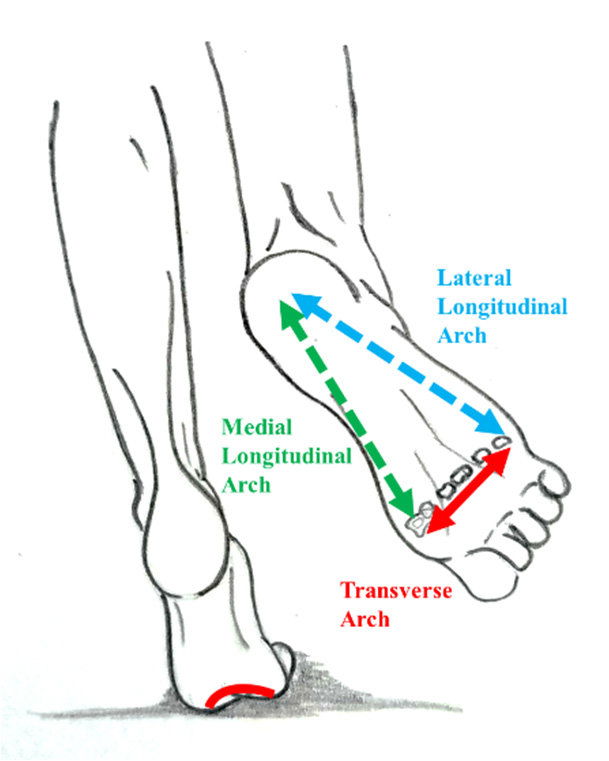 The Truth About Arch Support - A Meta Analysis of 150 Studies