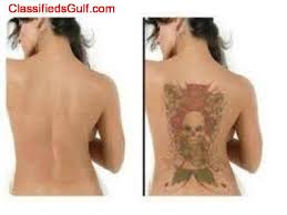 BEST TATTOO REMOVAL CREAM OR GEL+27635694687 in South Africa