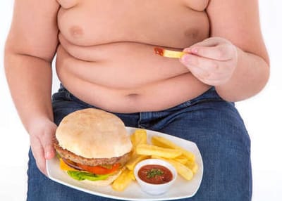 CAUSAS Y CONSECUENCIAS DE OBESIDAD INFANTIL image