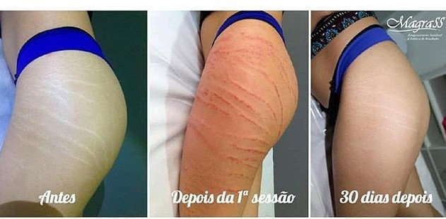 AdeuSS as ESTRIAS...