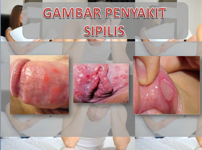 Obat Penis Bengkak Dan Timbul Gelembung Diapotik