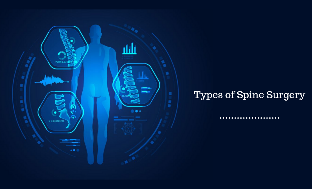 Types of Spine Surgery