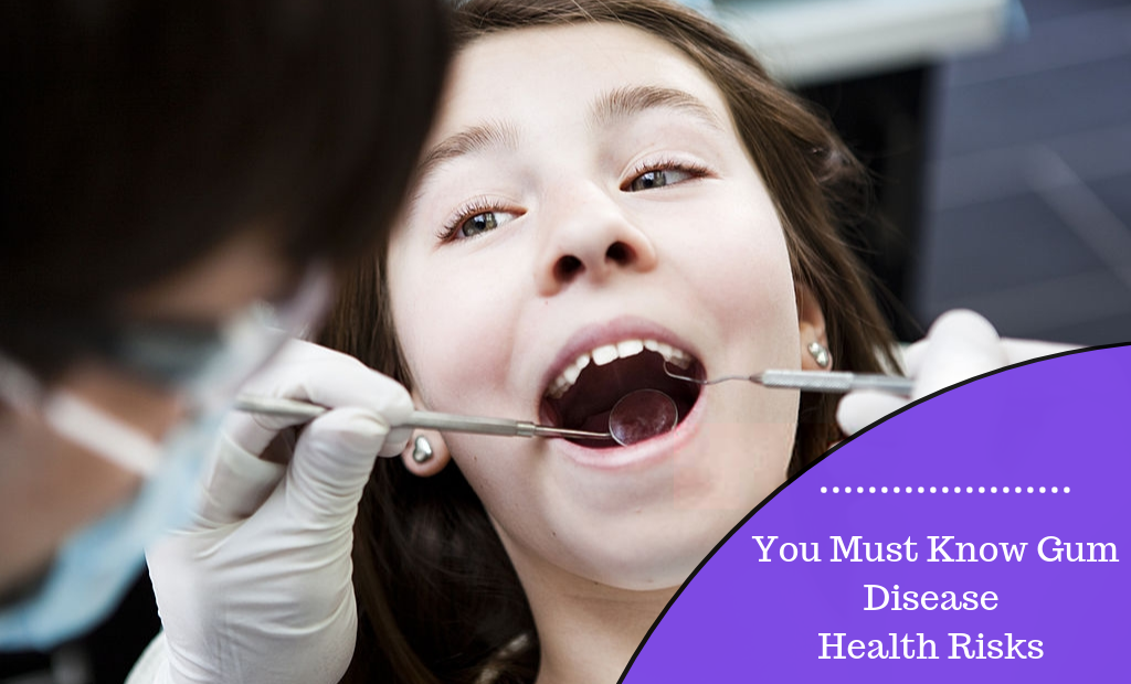 You Must Know Gum Disease Health Risks