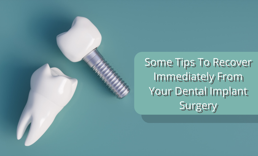 Some Tips To Recover Immediately From Your Dental Implant Surgery