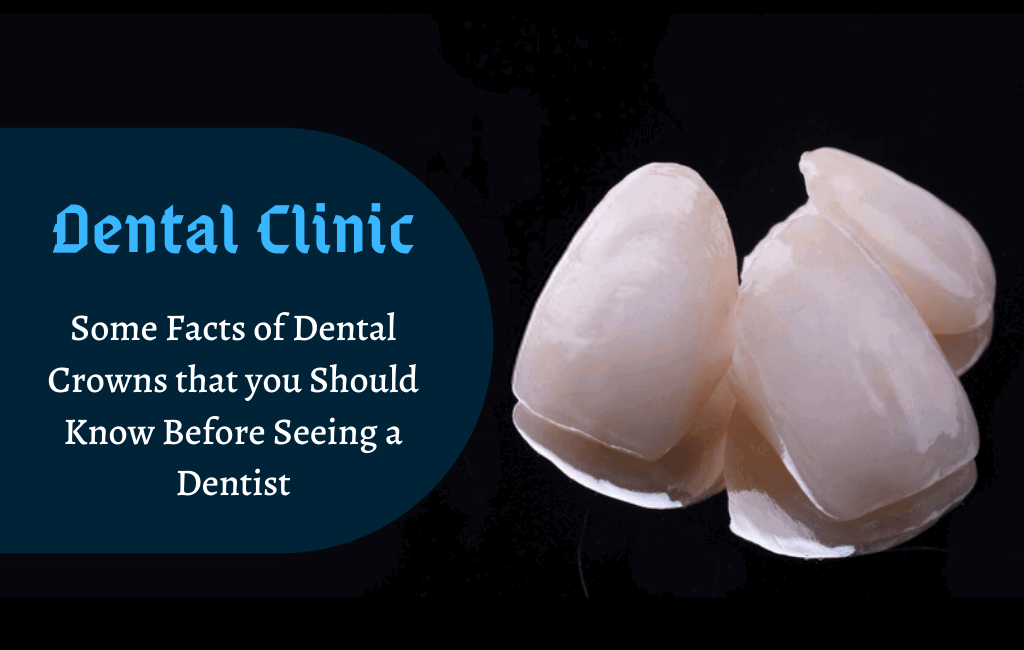 Some Facts of Dental Crowns that you Should Know Before Seeing a Dentist