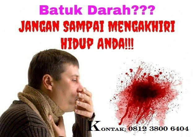 17+ Cara alami mengobati Batuk Berdarah