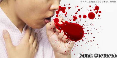 3+ Nama Obat Batuk Keluar Darah Di Apotik Paling Manjur
