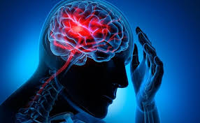 ACCIDENTE CEREBRO VASCULAR (A.C.V)