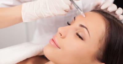 BOTOX image