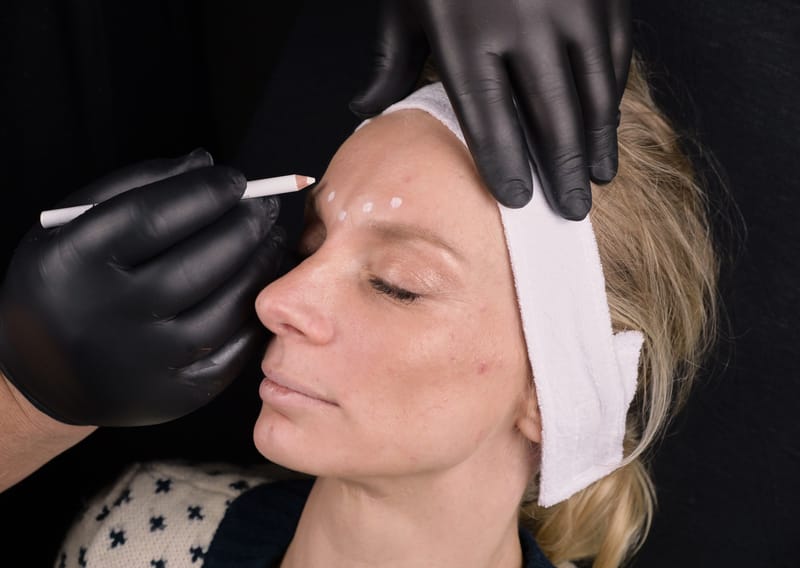 5 dagers Intensivkurs innen fillere og Botox for Sykepleiere og Leger