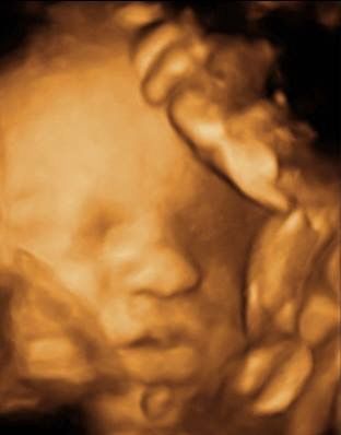 Ecografia 3D e 4 D image