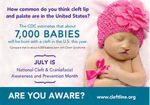 CLEFT AND CRANIOFACIAL AWARENESS MONTH JULY 2017