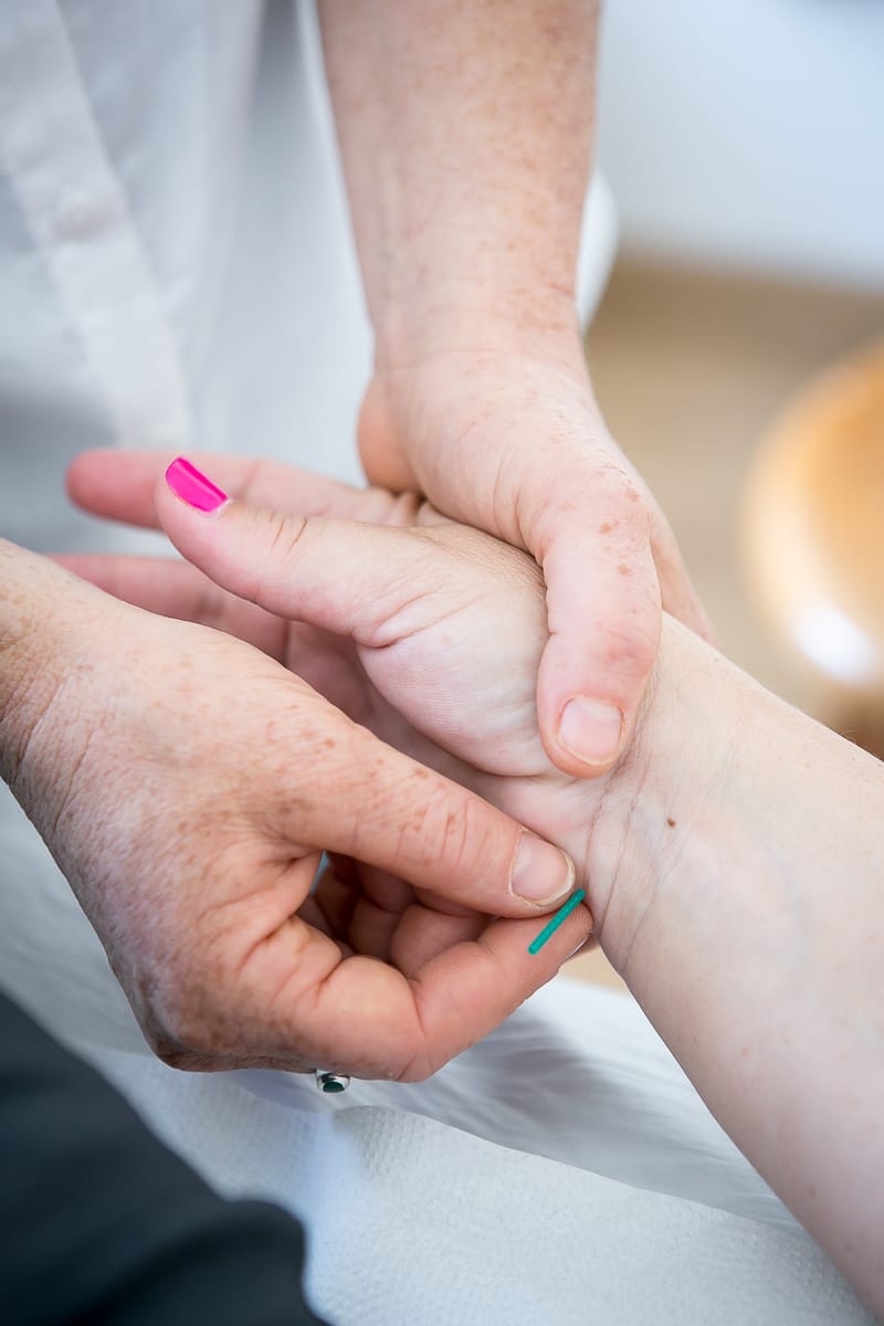 טיפולי פוריות אינטגרטיביים - עבודה עם דיקור - יום עיון