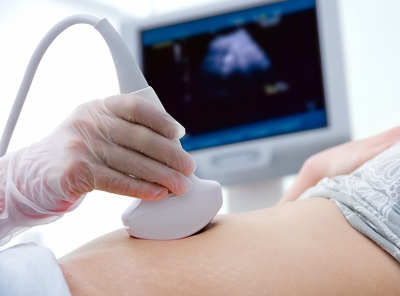 ULTRASONIDO CONVENCIONAL, ARTICULAR Y DOPPLER