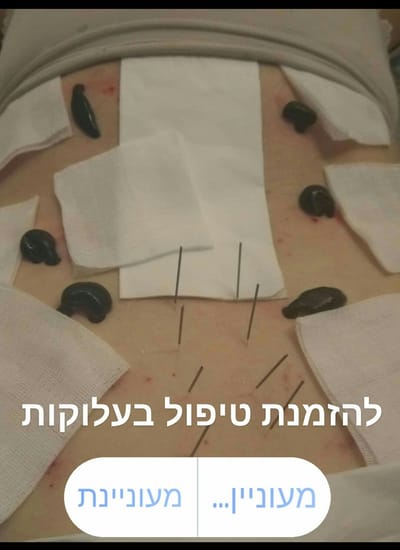 אודות image