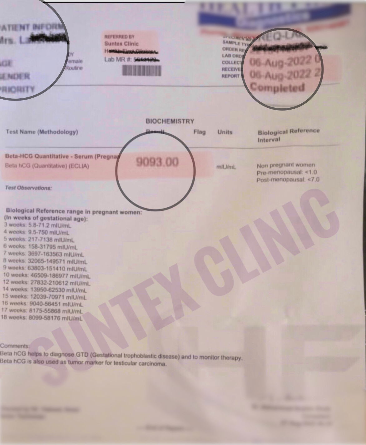 Beta Hcg progressing