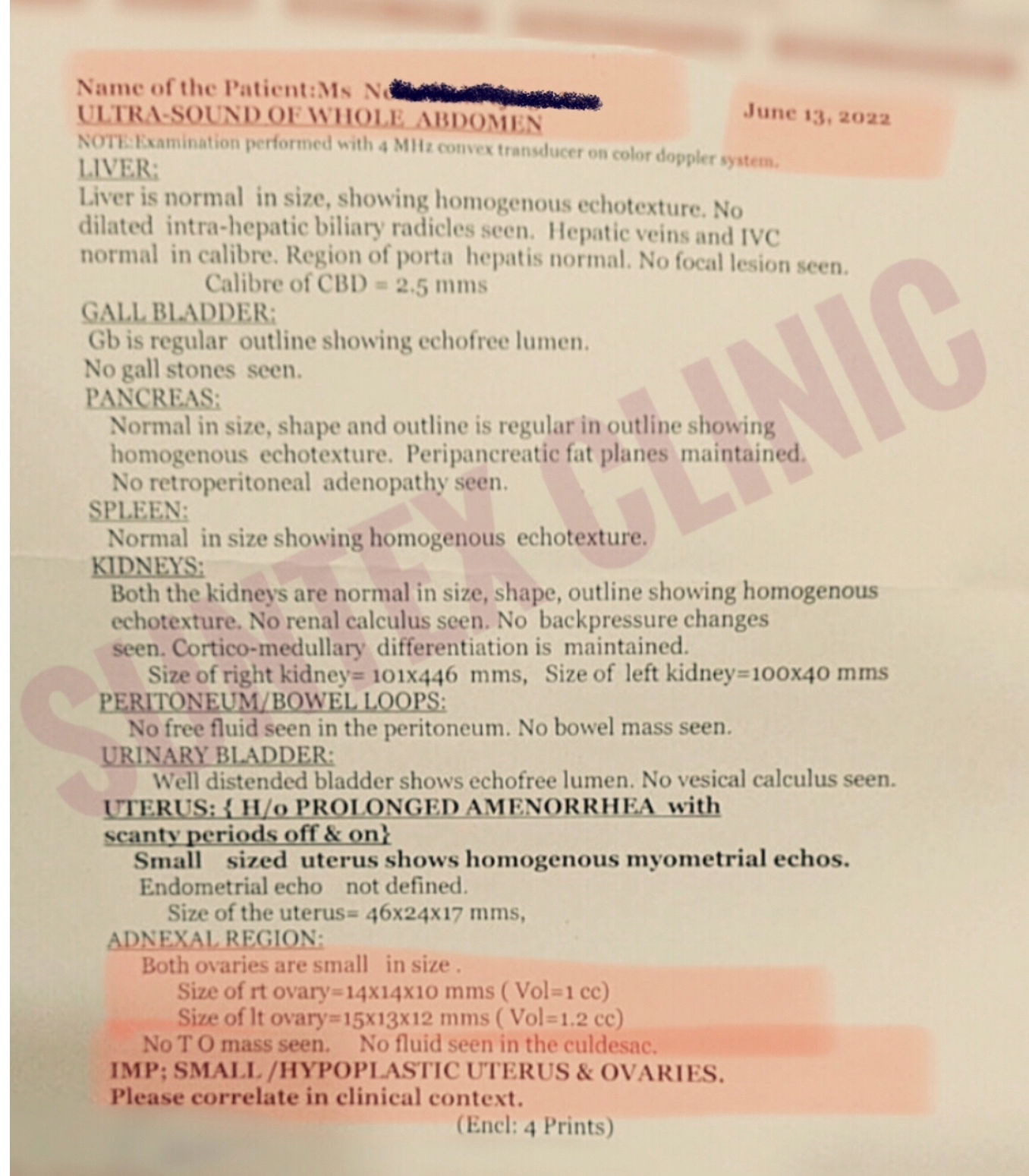 Ms N.... ( small ovaries/uterus with prolong amenorrhea)