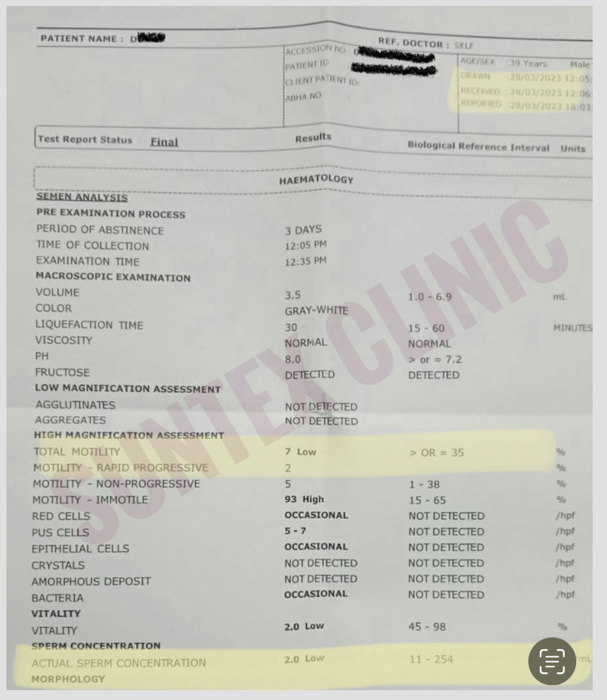 Mr D azoospermia corrected