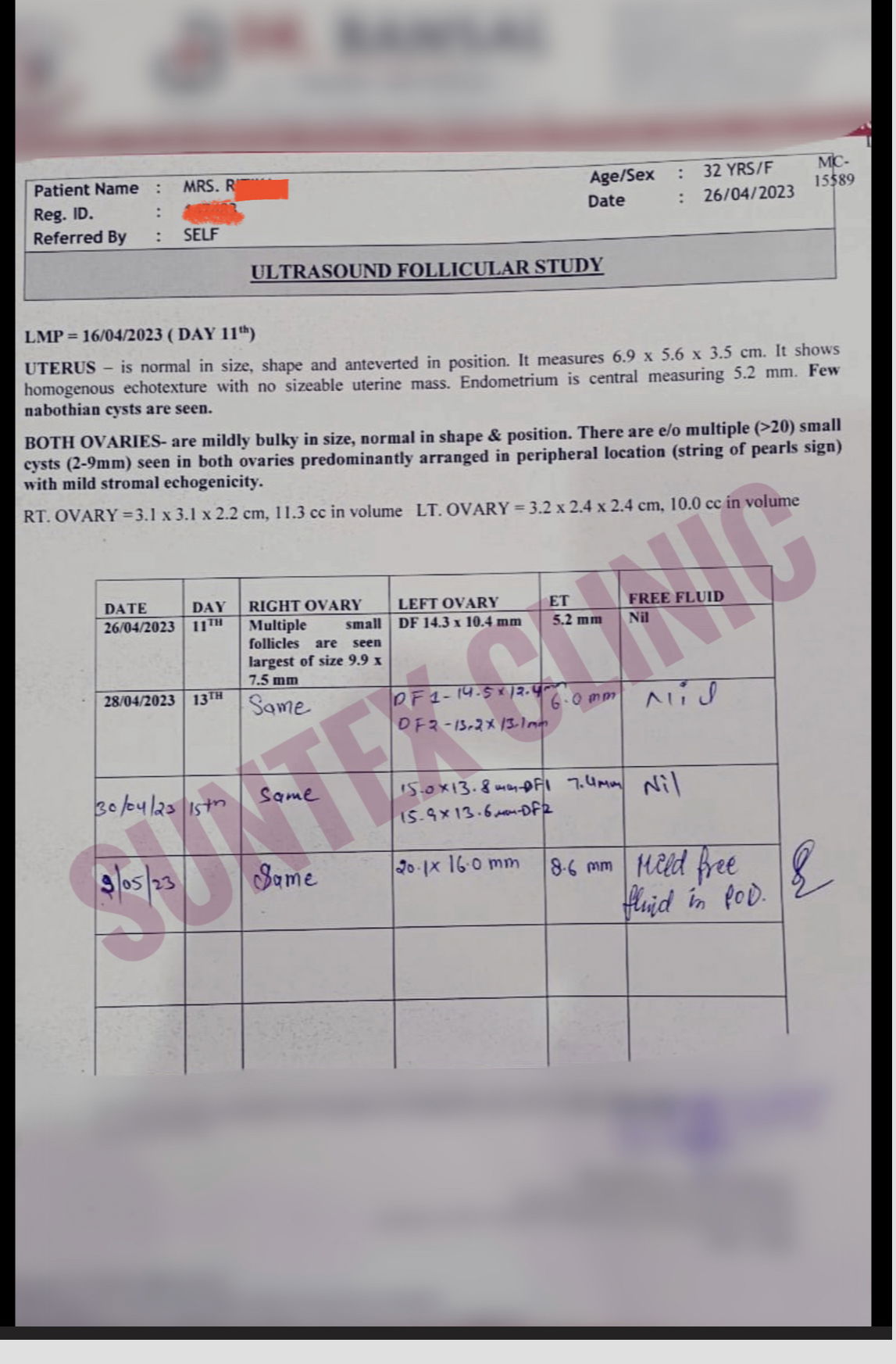 Fibroid and cyst corrected