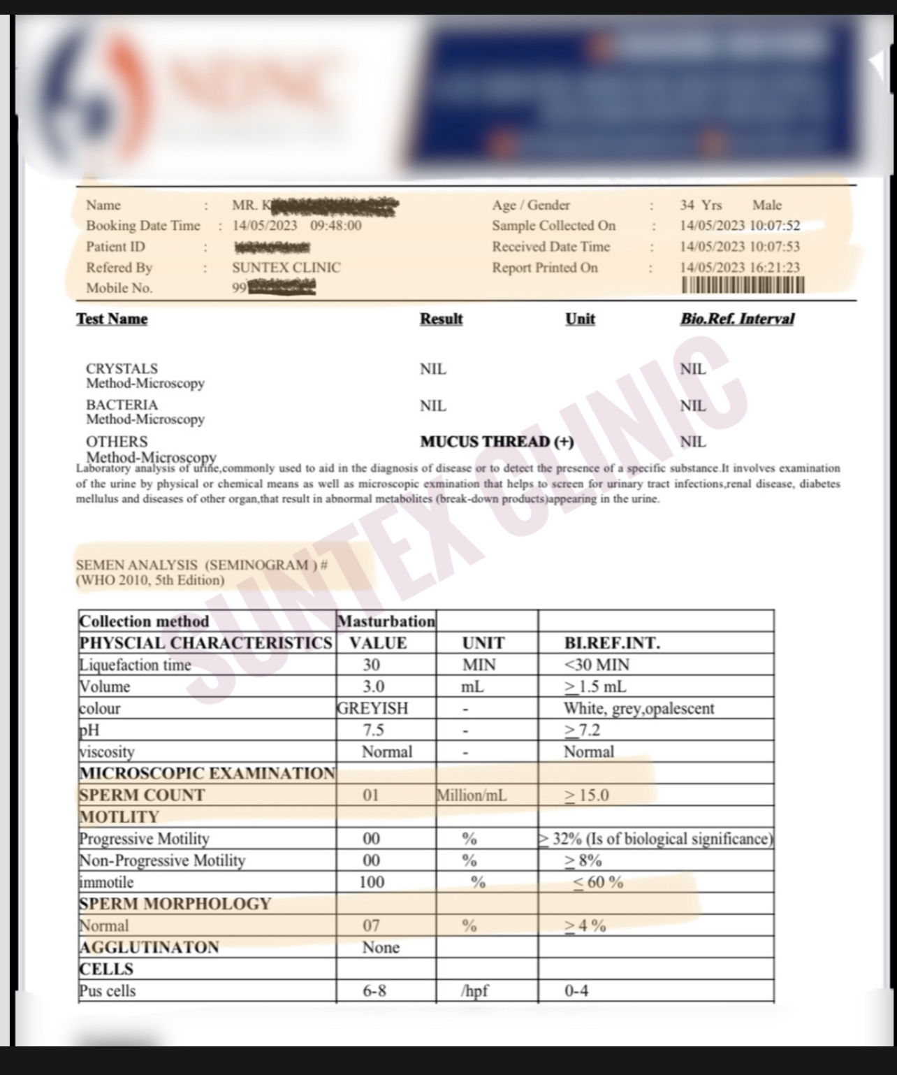 Azoospermia corrected