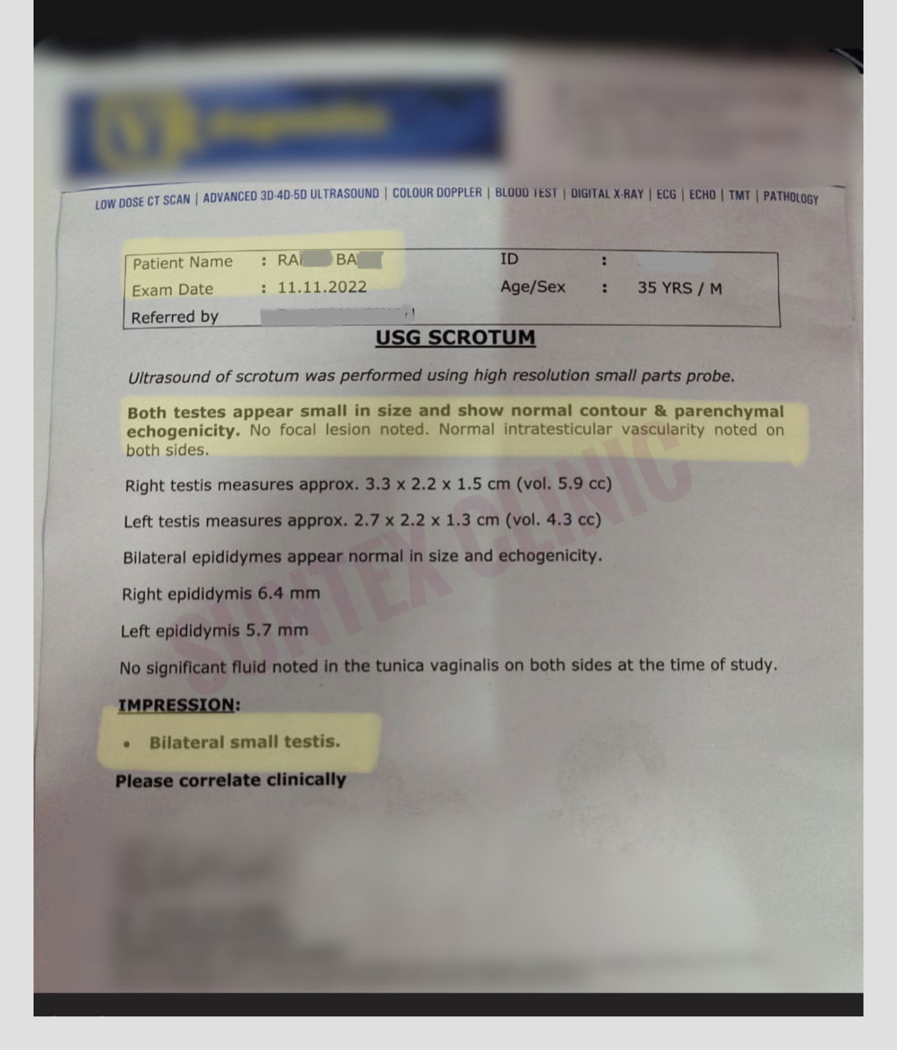 Mr Ra … ultrasound scrotum - small testis nov 2022