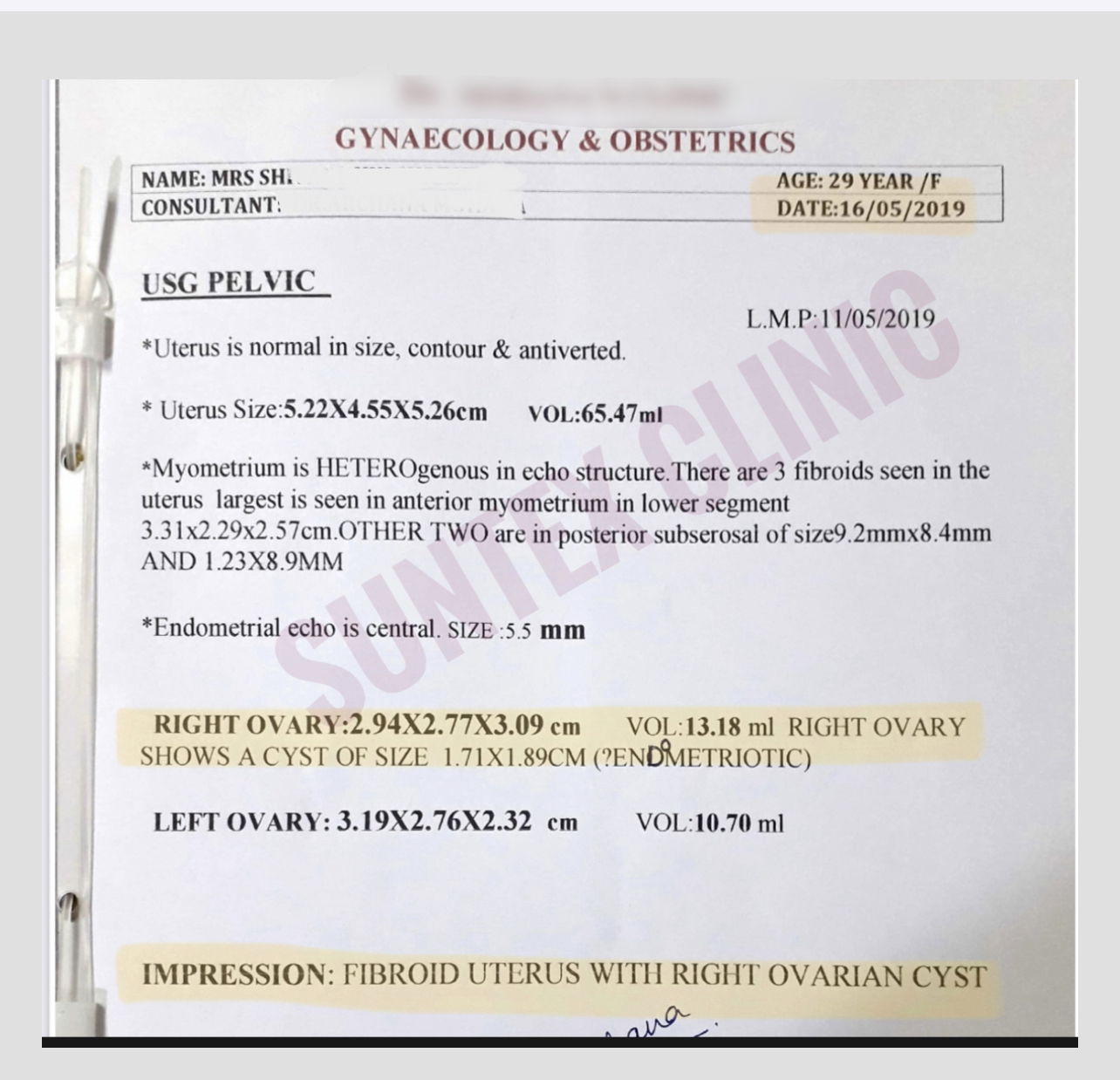 Mrs Sh (initial report ,Endometriotic cyst)