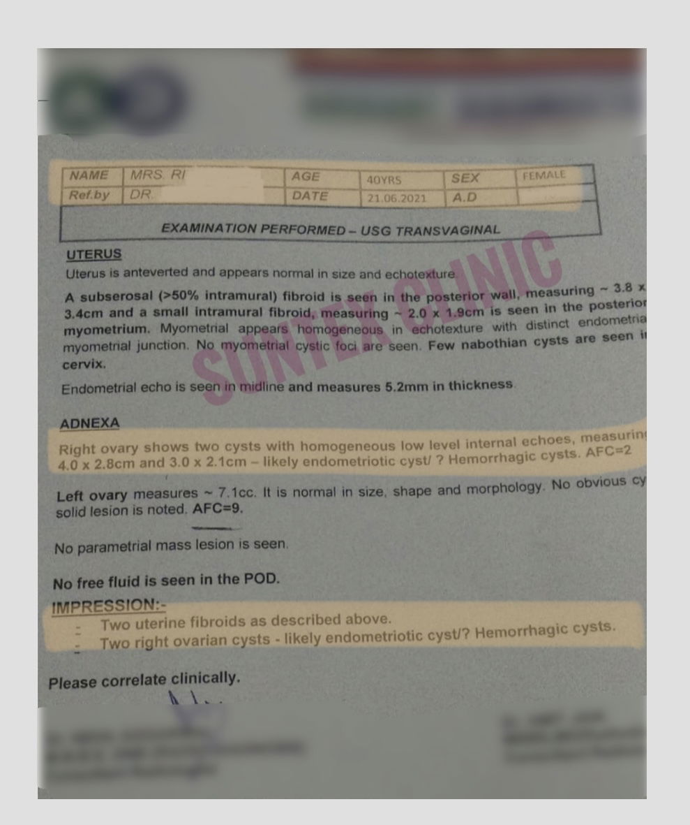 Mrs R  ( two endometriotic cysts with multiple fibroids)