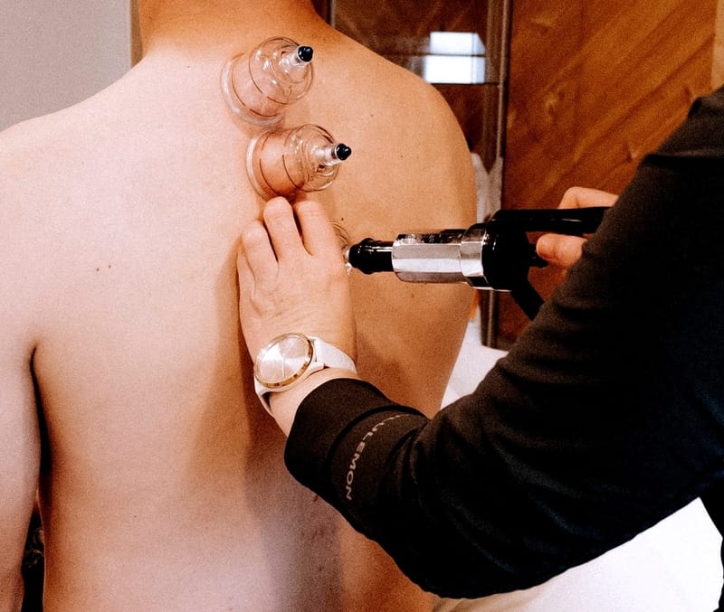 Cupping Therapy