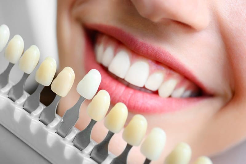 Cosmetic Dentistry or Cosmetic Bridges Which Can You Pick?