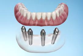 topdentalprofessionals image