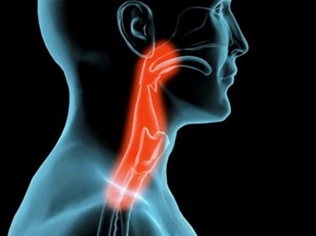 Trastornos de la Deglución