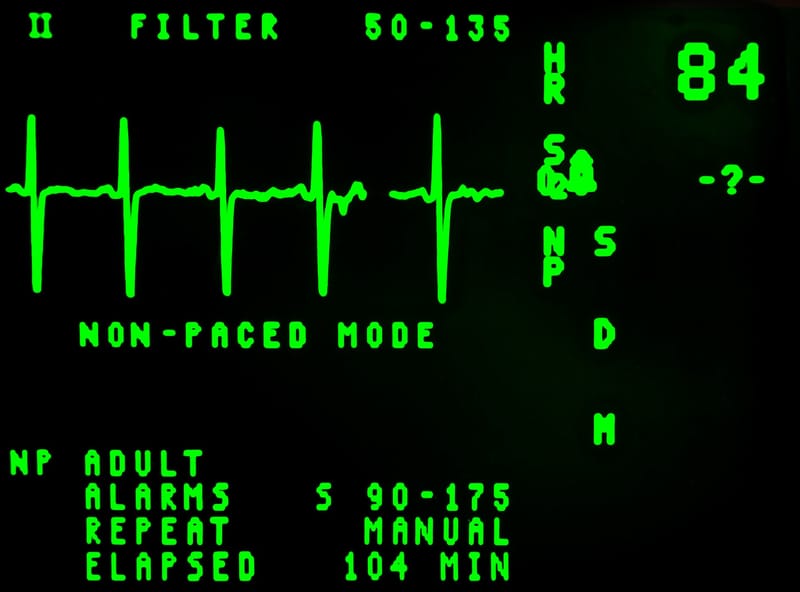 EKG Testing