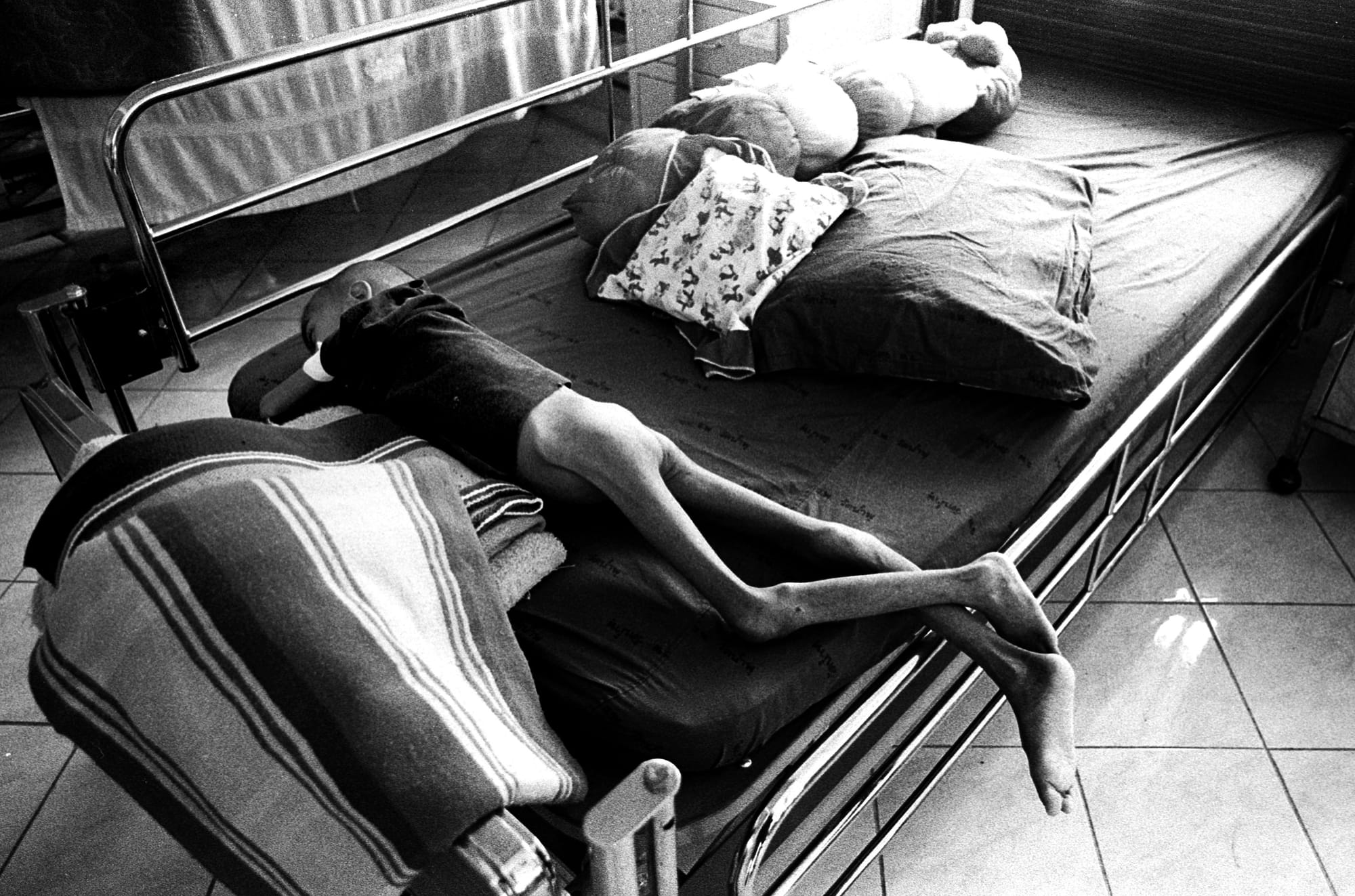 AIDS victim, Thailand, 1998.