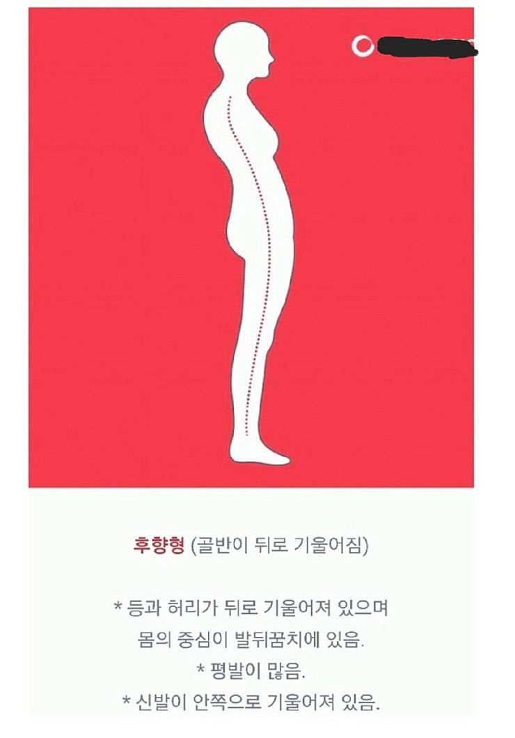 골반틀어짐 자가진단방법