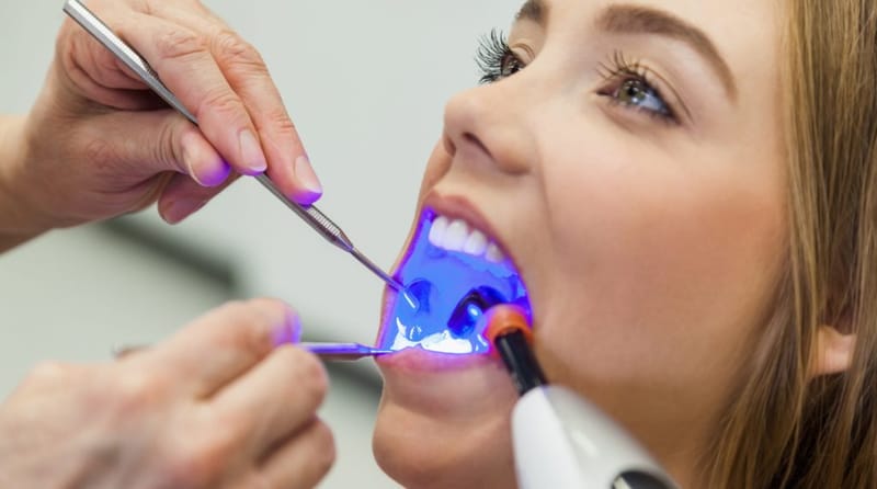 HOW YOU CAN TAKE CARE OF THE DENTAL FILLING?