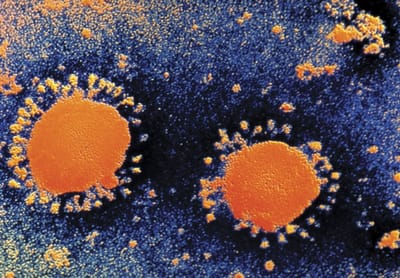 EU supera a China en número de muertos por coronavirus