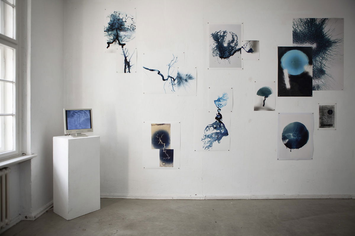 Installation view