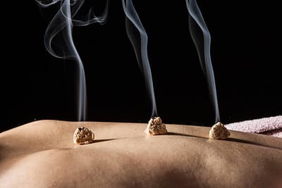 La moxibustion image