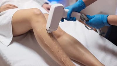 IPL Hair Removal image