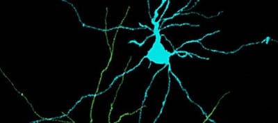 Diferencia entre Plasticidad neuronal y Neuro plasticidad