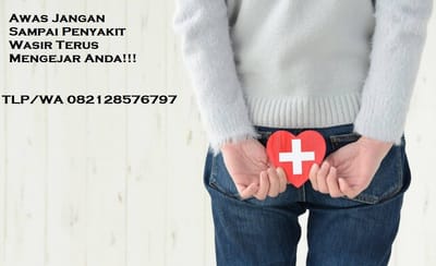 Obat Wasir Alami Untuk Anus Bengkak Disertai Nyeri Akibat Meradang